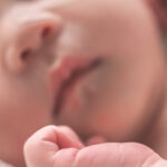 noworodek dysplazja oskrzelowo-płucna